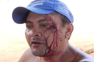 Maurício ‘Ceará’ alegou que foi agredido sem motivos 