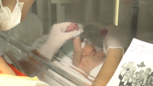 Fisioterapeuta realiza procedimento que recebe o nome de "estimulação precoce"